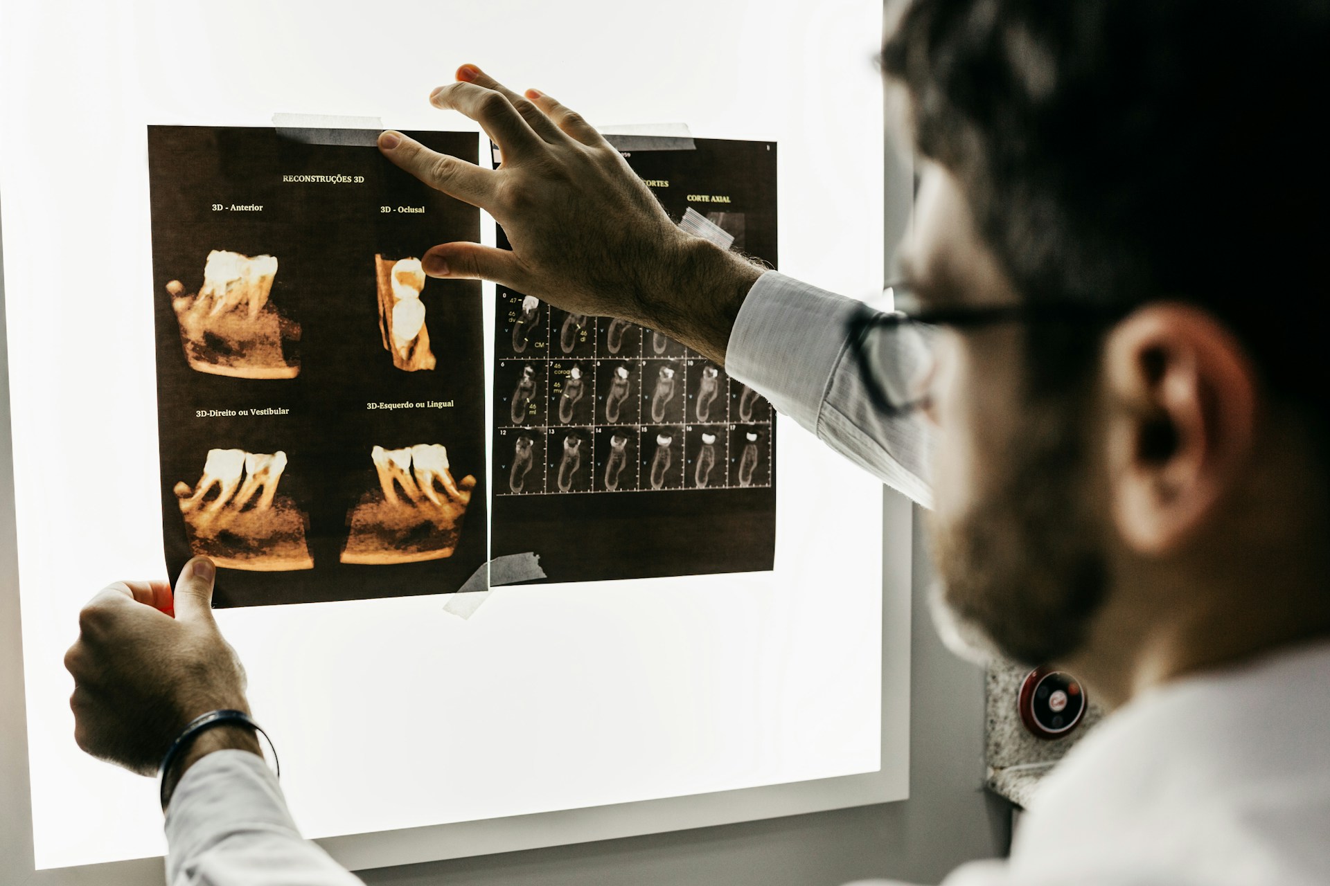 X-ray dentist picture